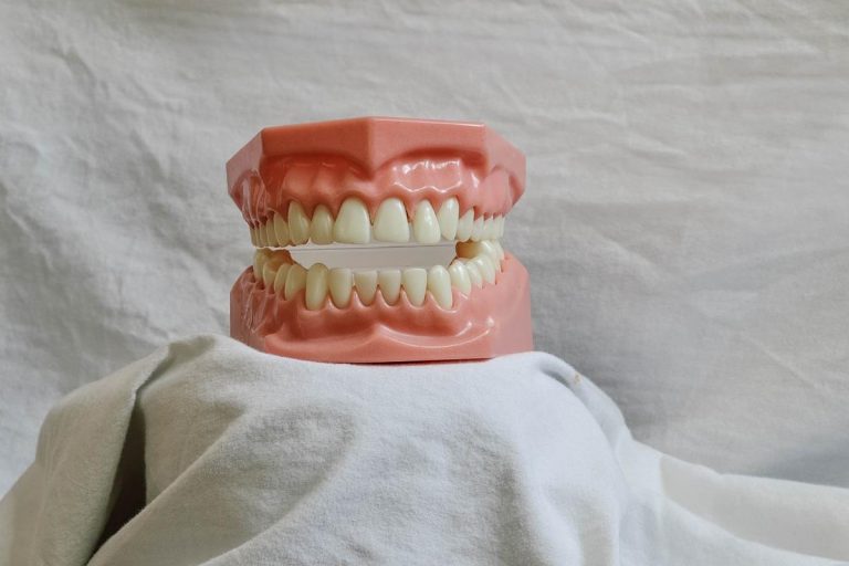 Implanty zębów – czy warto je wybrać? Zalety i cena