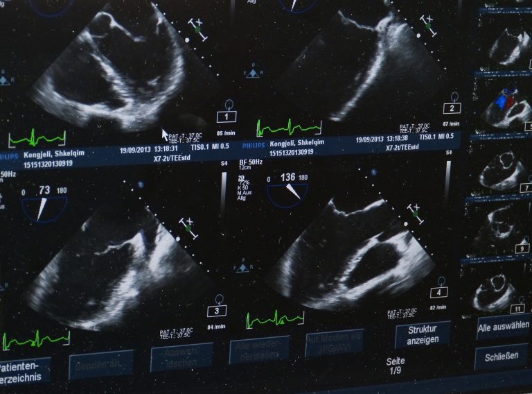 Echokardiografia - kluczowa metoda diagnostyczna w kardiologii